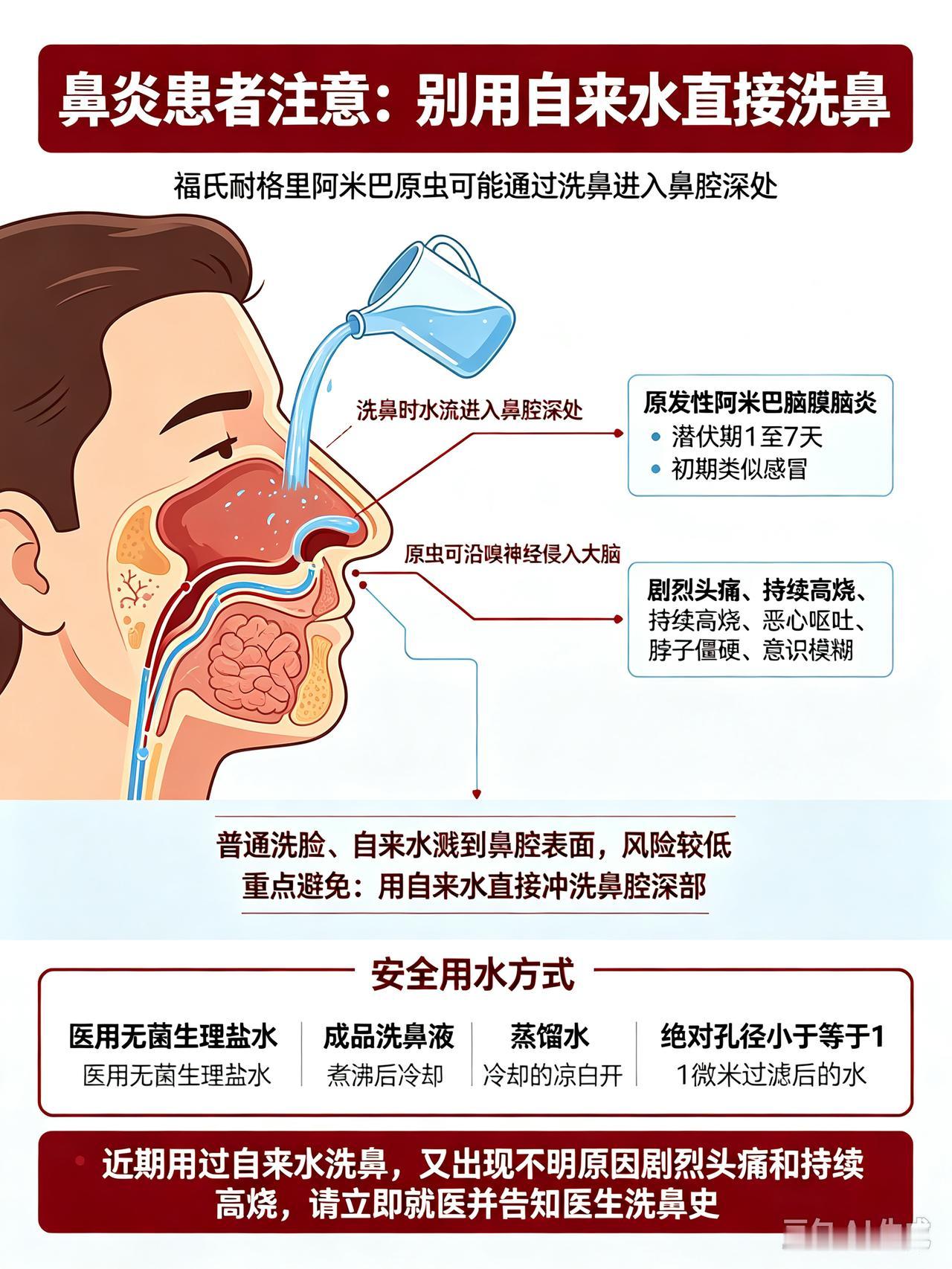 有鼻炎的伙伴要注意了！千万别再用这种方式缓解症状。本人有多年鼻炎史，一到换