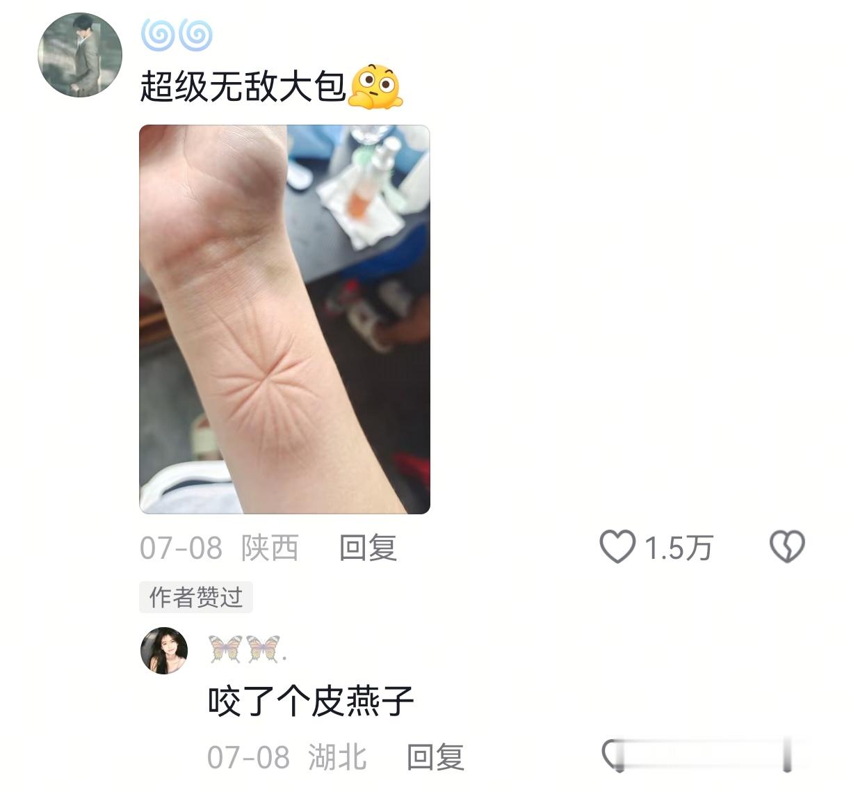 去云南旅游的人嘴是真的严啊，那么毒的蚊子那么大个包