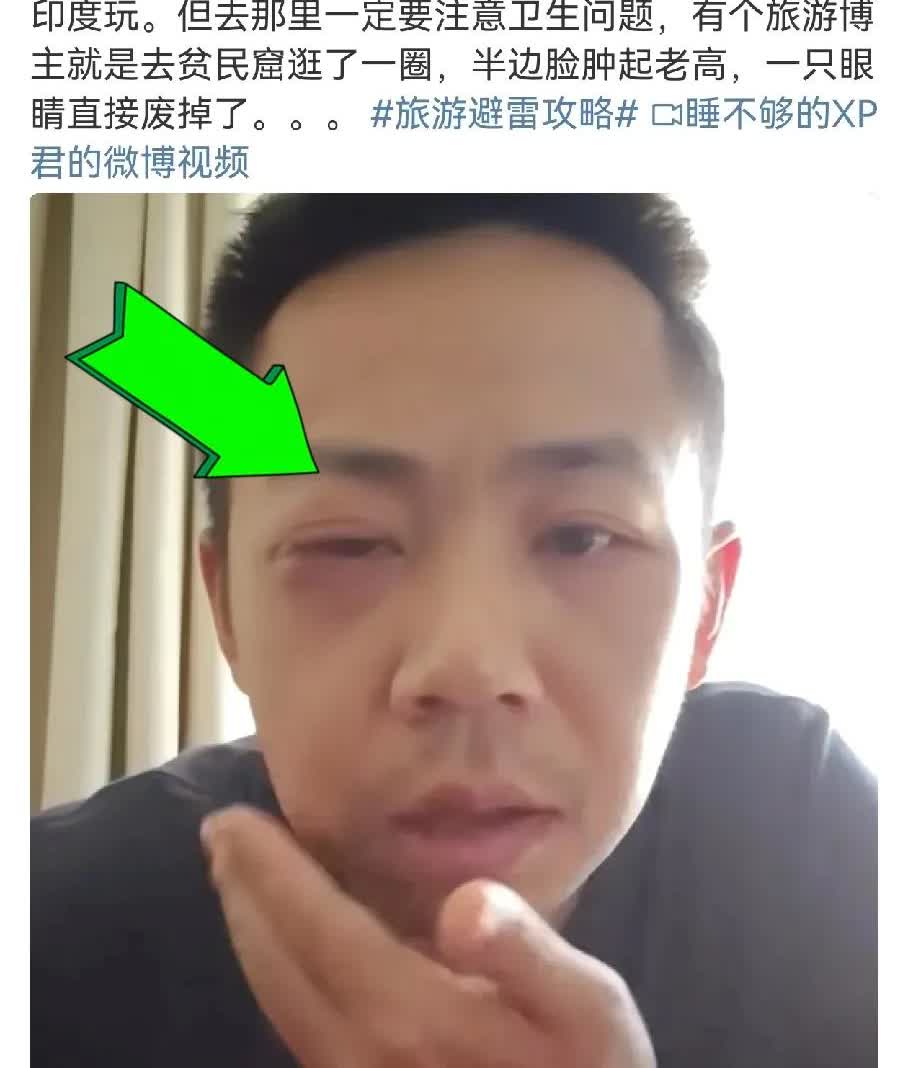 就很难评：印度刚对华开放签证，就有博主生怕自己吃不到热乎的，屁颠屁颠第一时间奔赴