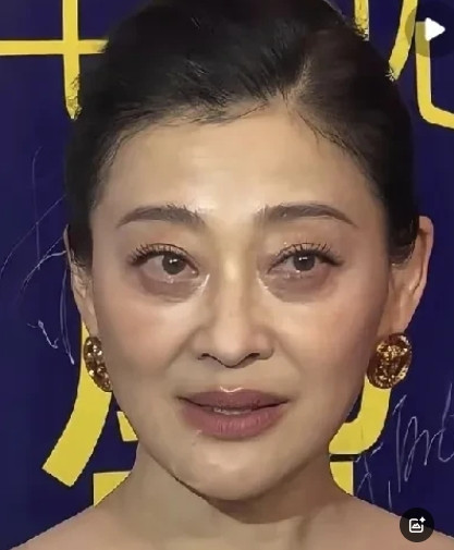 现在人追求年轻已经达到极致。身边有两个朋友都去打了除皱针，刚打完脸都浮囊着，过了