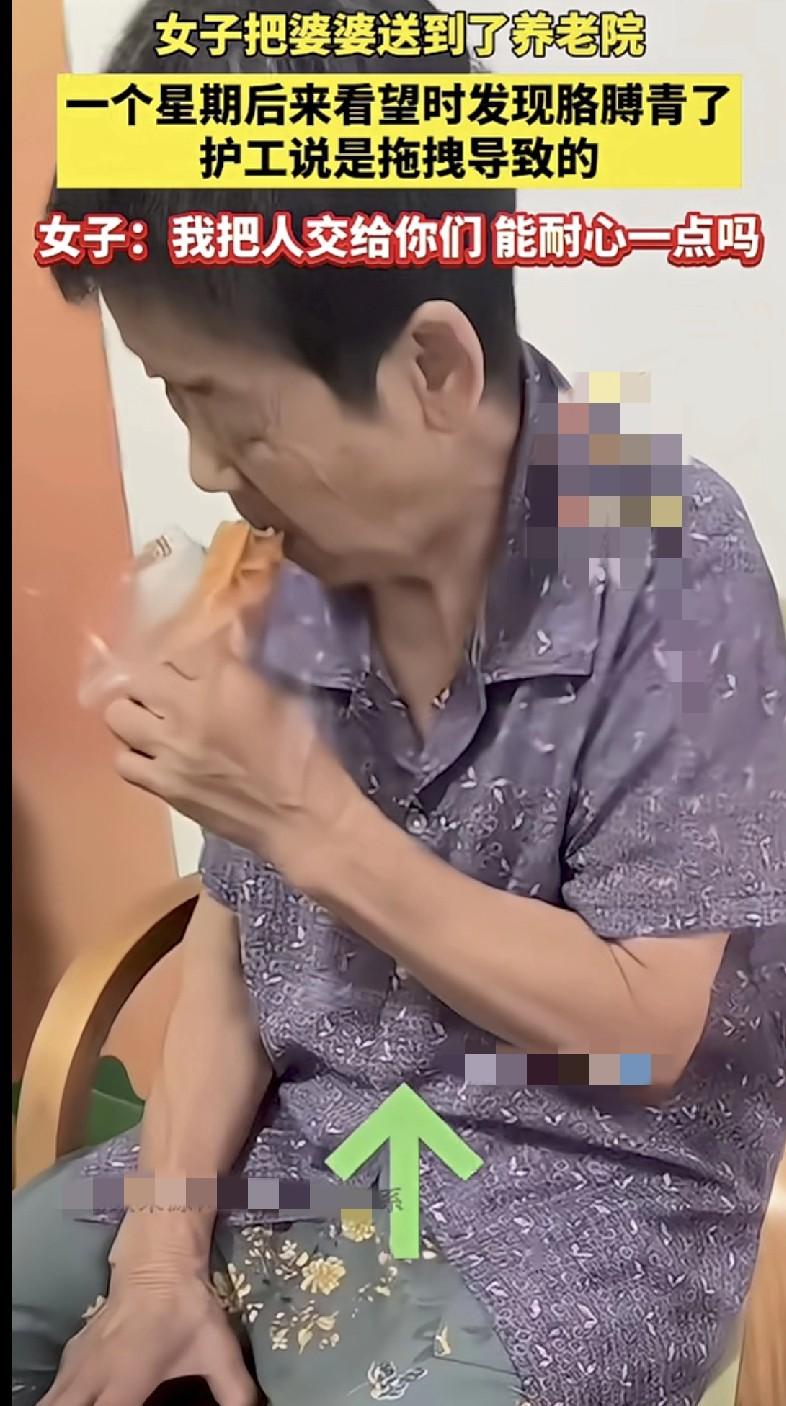 婆婆胳膊青了！护工一句“拖拽”女子当场炸裂这托底变砸底？监控死角+人