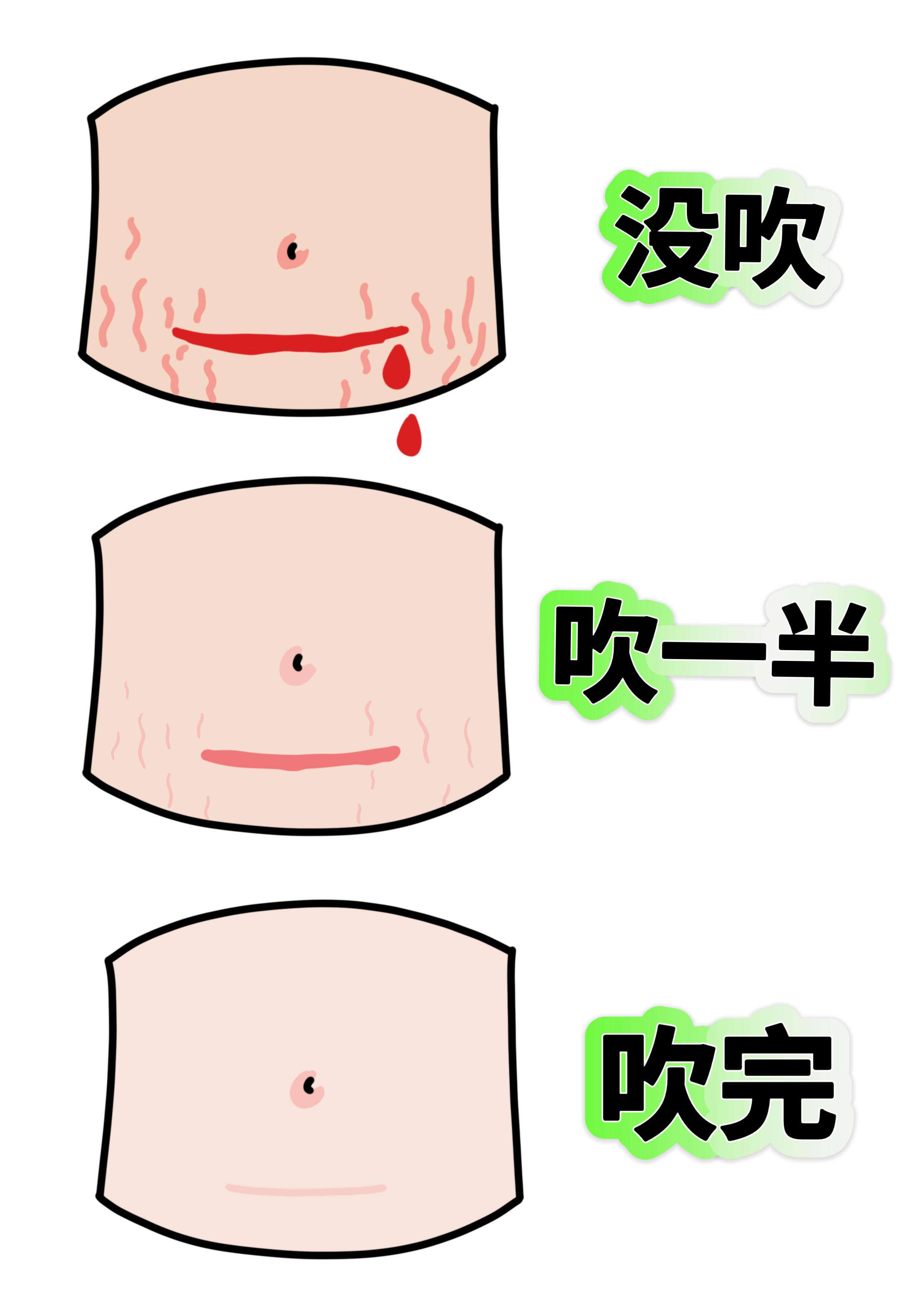 剖腹产就每天吹吹吹​​​