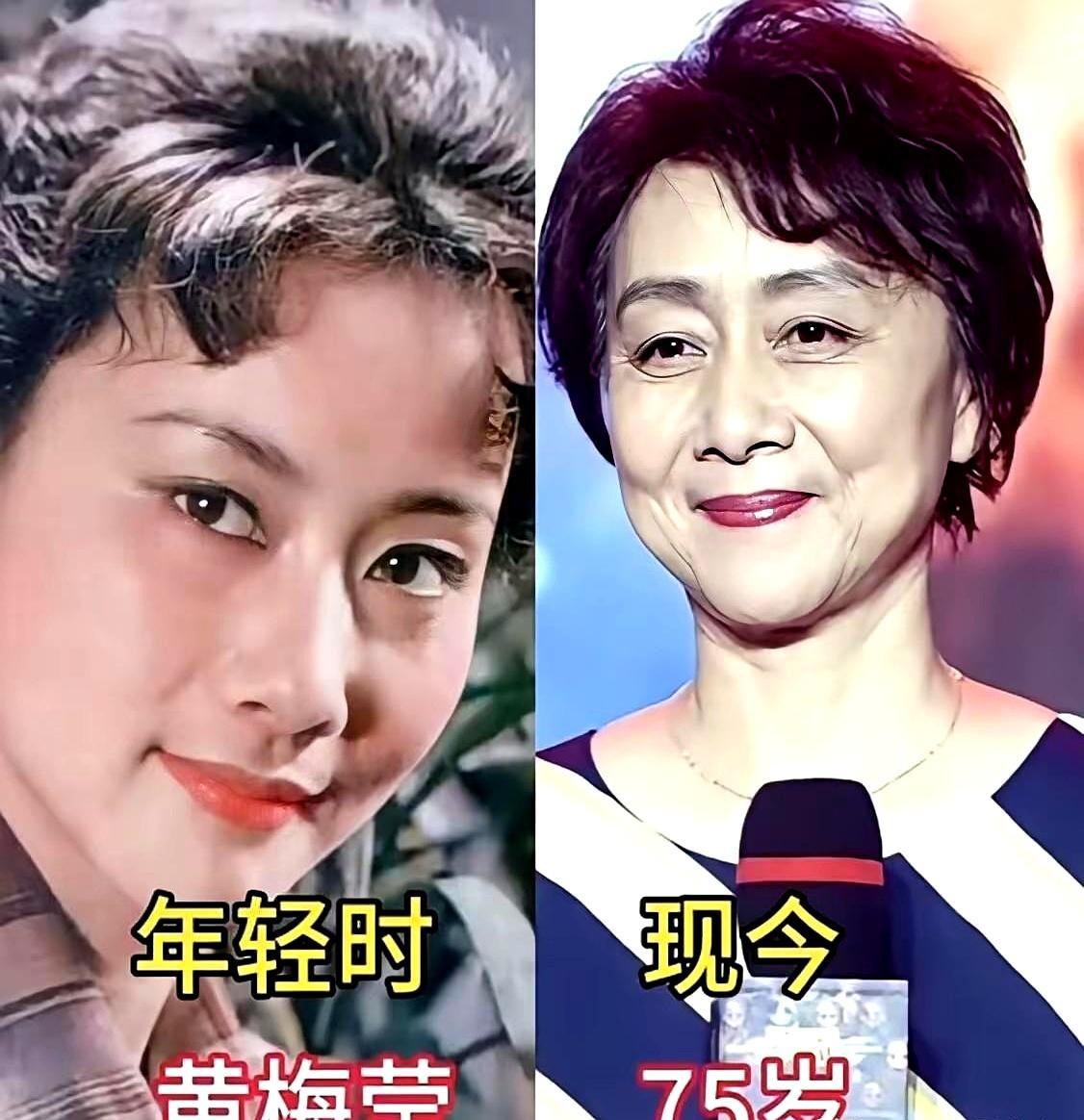 李嘉欣生图曝光，这次彻底崩了。曾被港媒评为“最美港姐”，如今面部凹陷，眼纹
