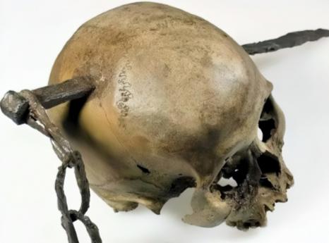 1974年，工人施工时，在罗马广场挖掘出一具骷髅头骨，一根铁钎穿透了头骨。这