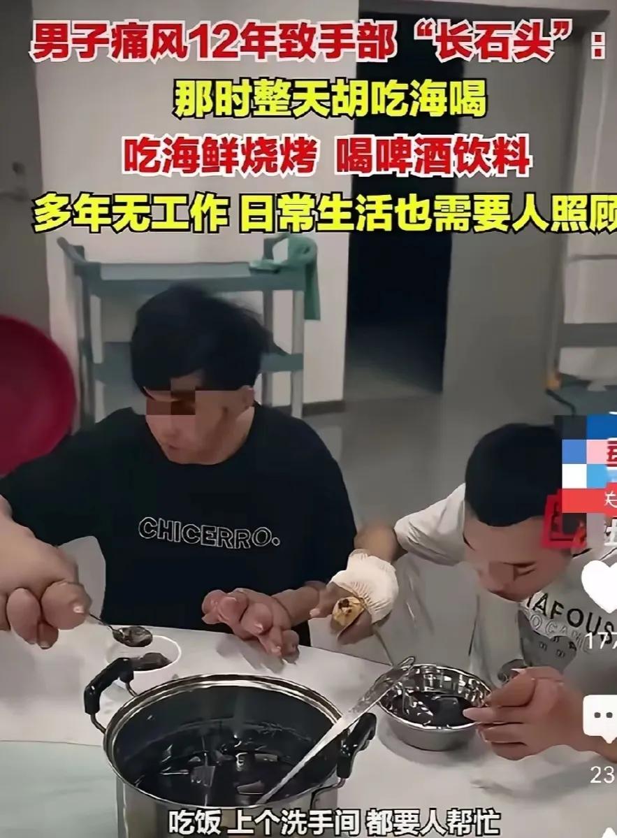 真的很难想象，这对父子已经痛风那么严重了，还依然如旧，该吃的吃，该喝的喝，把烧烤