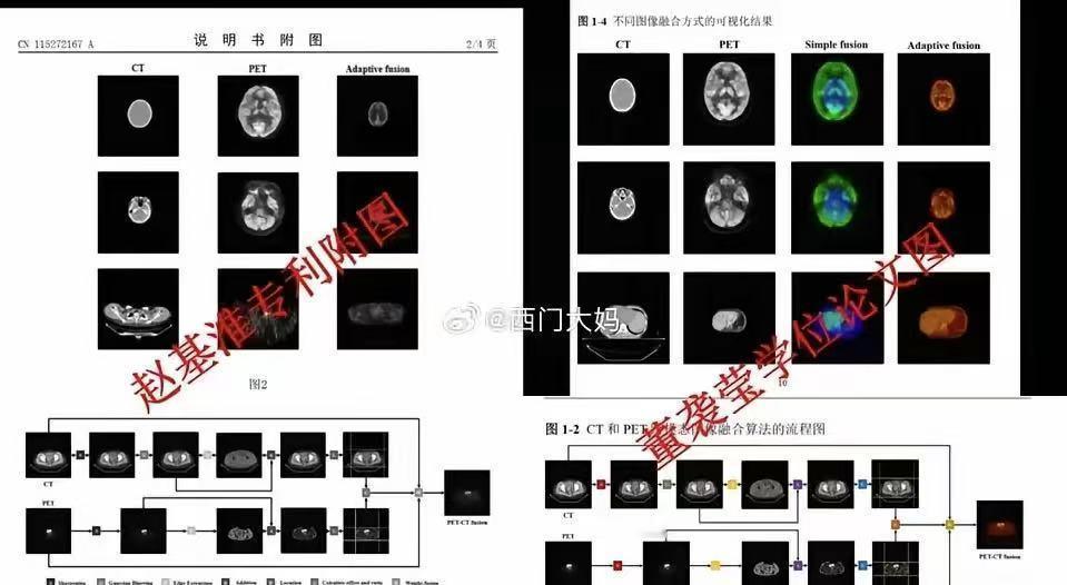 拔出萝卜带出泥！能保住董小姐的博士学位吗？她的论文被曝与北科大学生的专利雷同。和