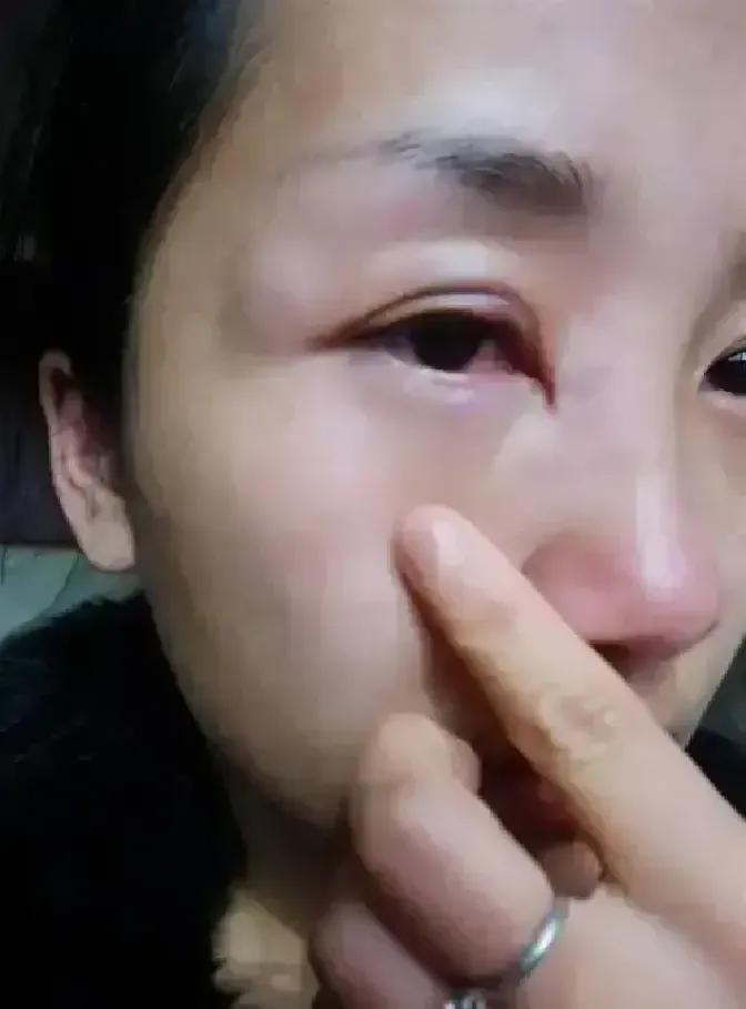 昨晚刷到一条匿名贴，一个妹子说结婚多年头一回被老公动手，推搡加拳头，身上青一块紫