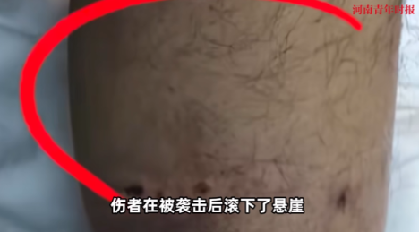 9月20日下午，重庆某山区上演惊险一幕：村民老李在采菌时遭遇200斤黑熊袭击，逃