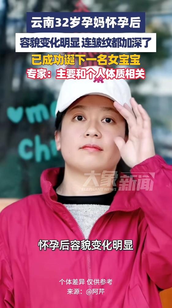 “太不容易了！”云南，一女子怀孕后，容貌发生了明显变化，不仅长痘毛孔粗大，连皱纹