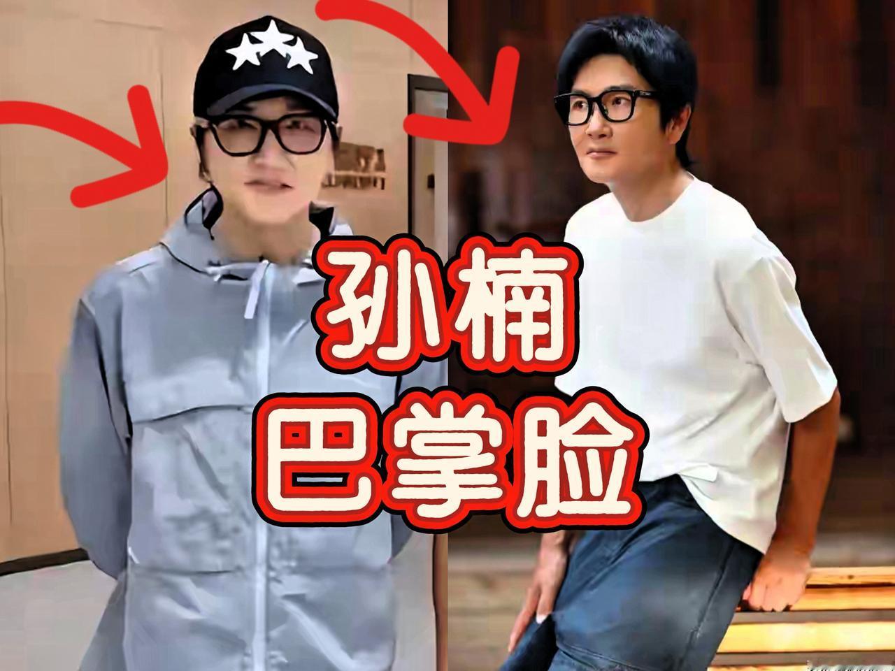 一开始我怀疑孙楠健康出了问题，到后来我怀疑是路人街拍角度的问题，直到我把那段