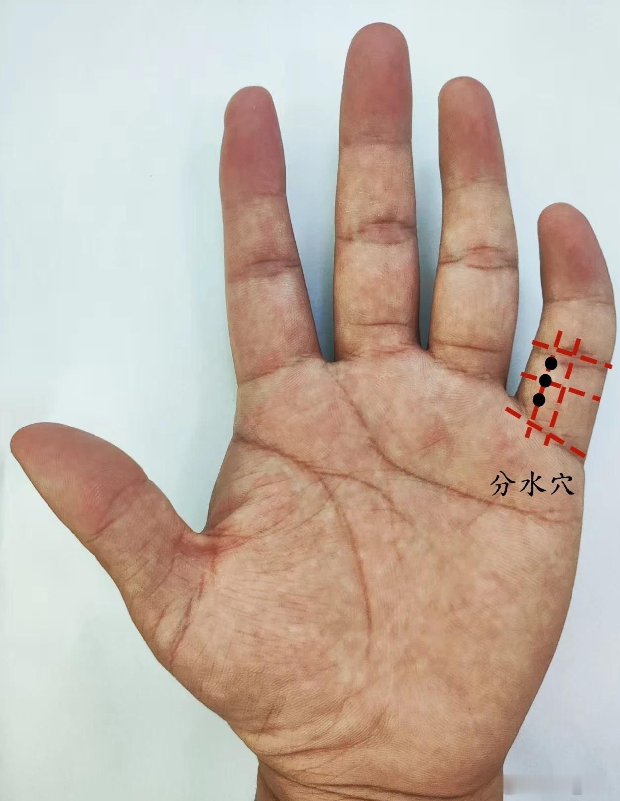 腰痛，分水穴分水穴源自董氏奇穴位置：在手掌面，小指第一节中央线偏桡侧三分线上，