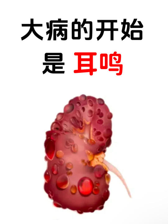 耳鸣，其实就是肝病 - 耳鸣，低级的中医会告诉你耳鸣只是耳窍之疾，高级...