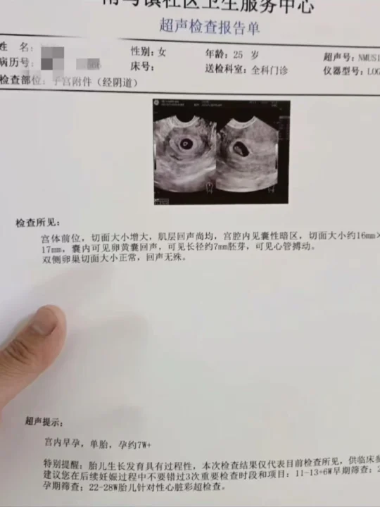 听说好孕会传染！不知道下一个接力棒会是谁