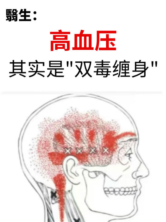 高血压 其实是双毒缠身 别再走冤枉路 - 有许多人患上高血压后，四处寻...