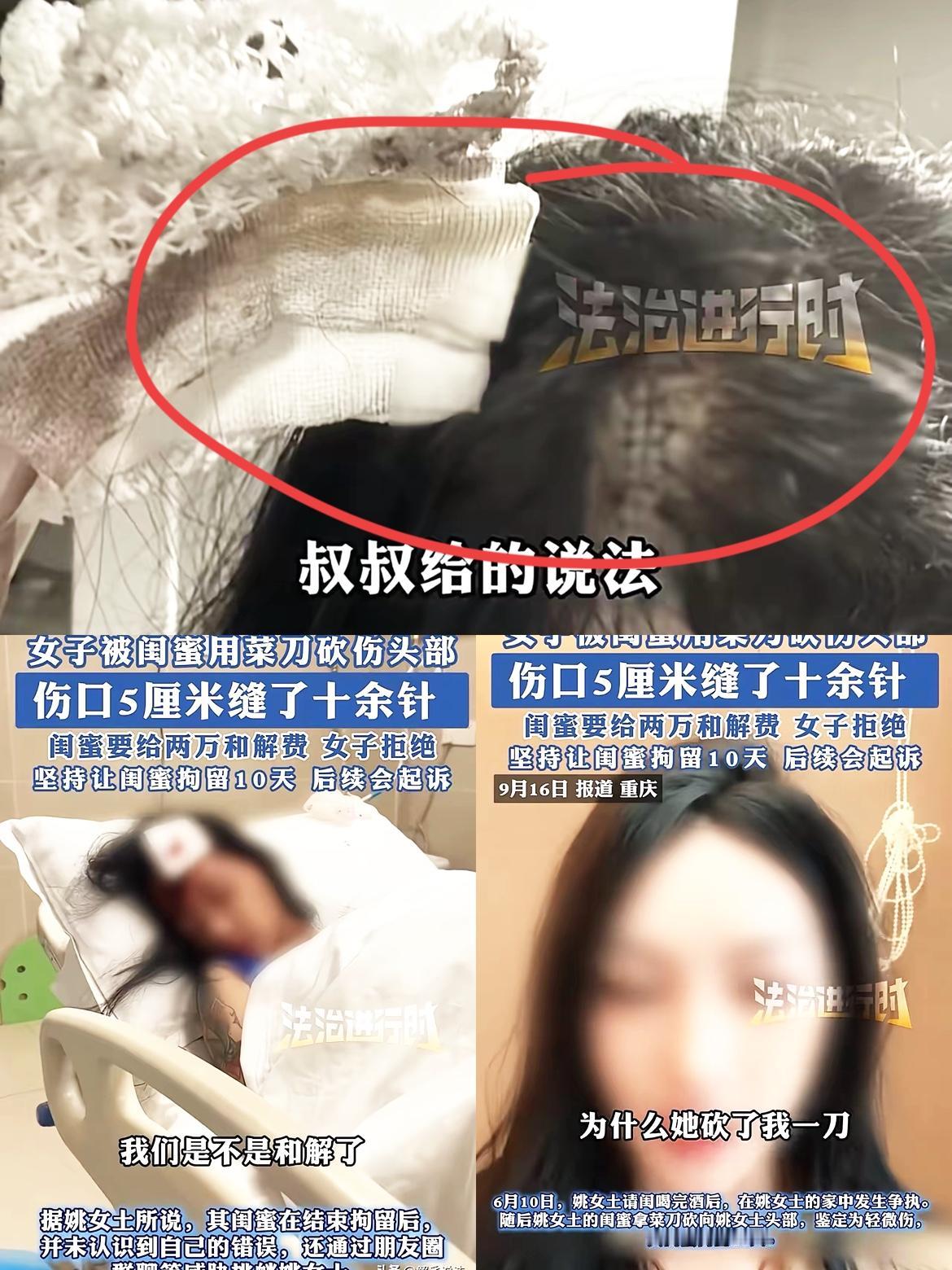 你能想象吗？和闺蜜吃顿饭，最后竟被菜刀砍头！重庆的姚女士就碰上了这糟心事，