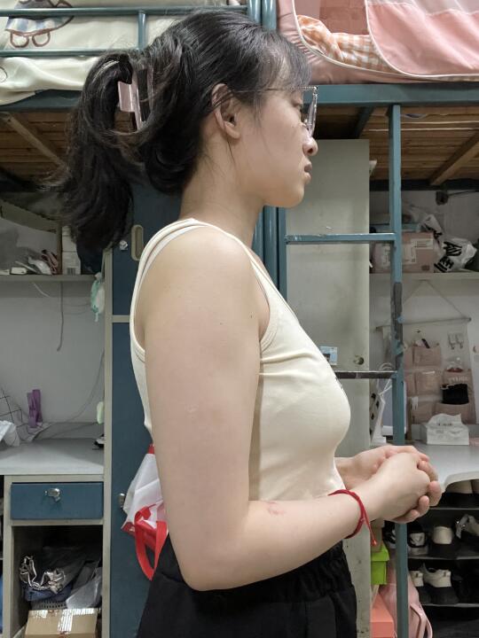 瘦手臂我真的🐮