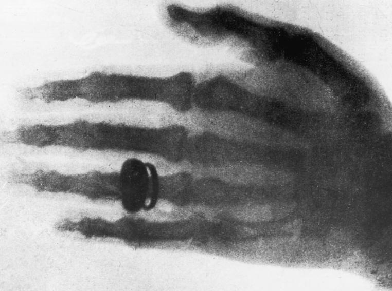 传说中的透视术，居然是真的，还救了无数人！一位物理学家在实验中意外发现一种恐