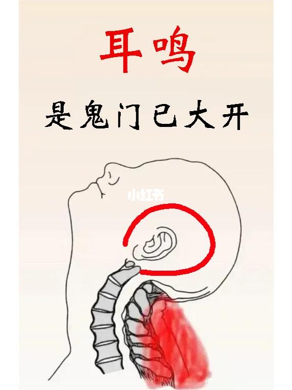 耳鸣，请坚持一个月