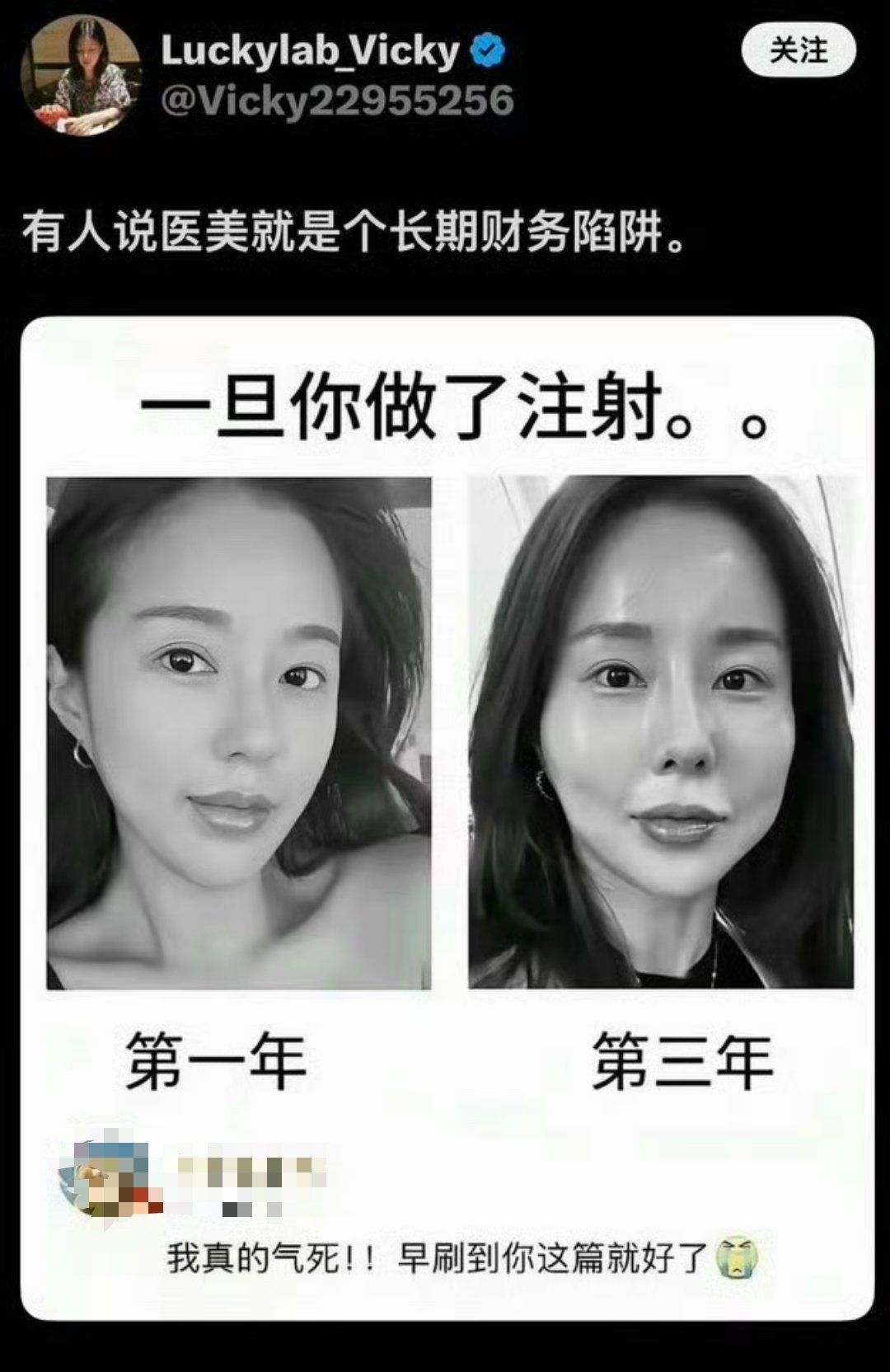 这就是医美可怕的地方，会停不下来，越整越歪​​​