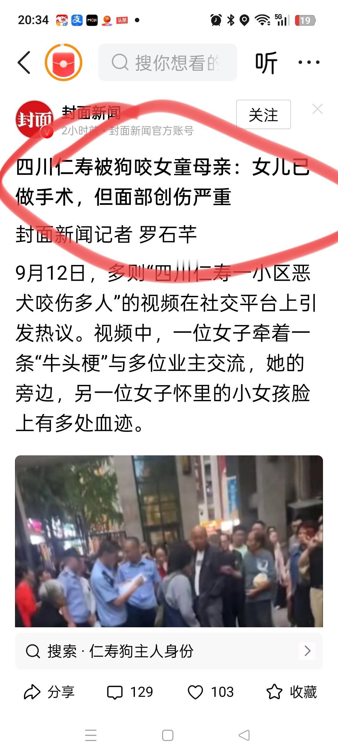 这位女狗主人肠子都悔青了！受伤的女孩妈妈说：目前女儿已经做完了手术，但脸部的创伤