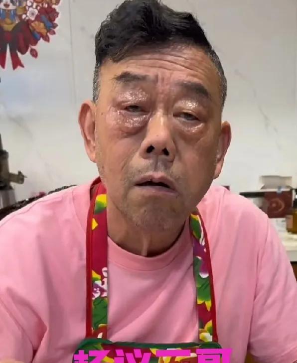 杨议三哥的眼睛真应该去看看，他不光是眼袋大，怎么连上眼皮都肿了呢？而且还油光光的