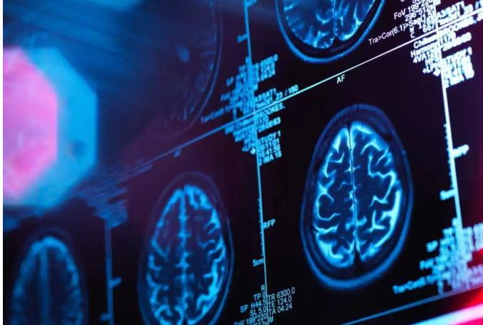 剑桥研究人员称人类大脑32岁才真正“成年”，一生有4次关键转折，真是这样