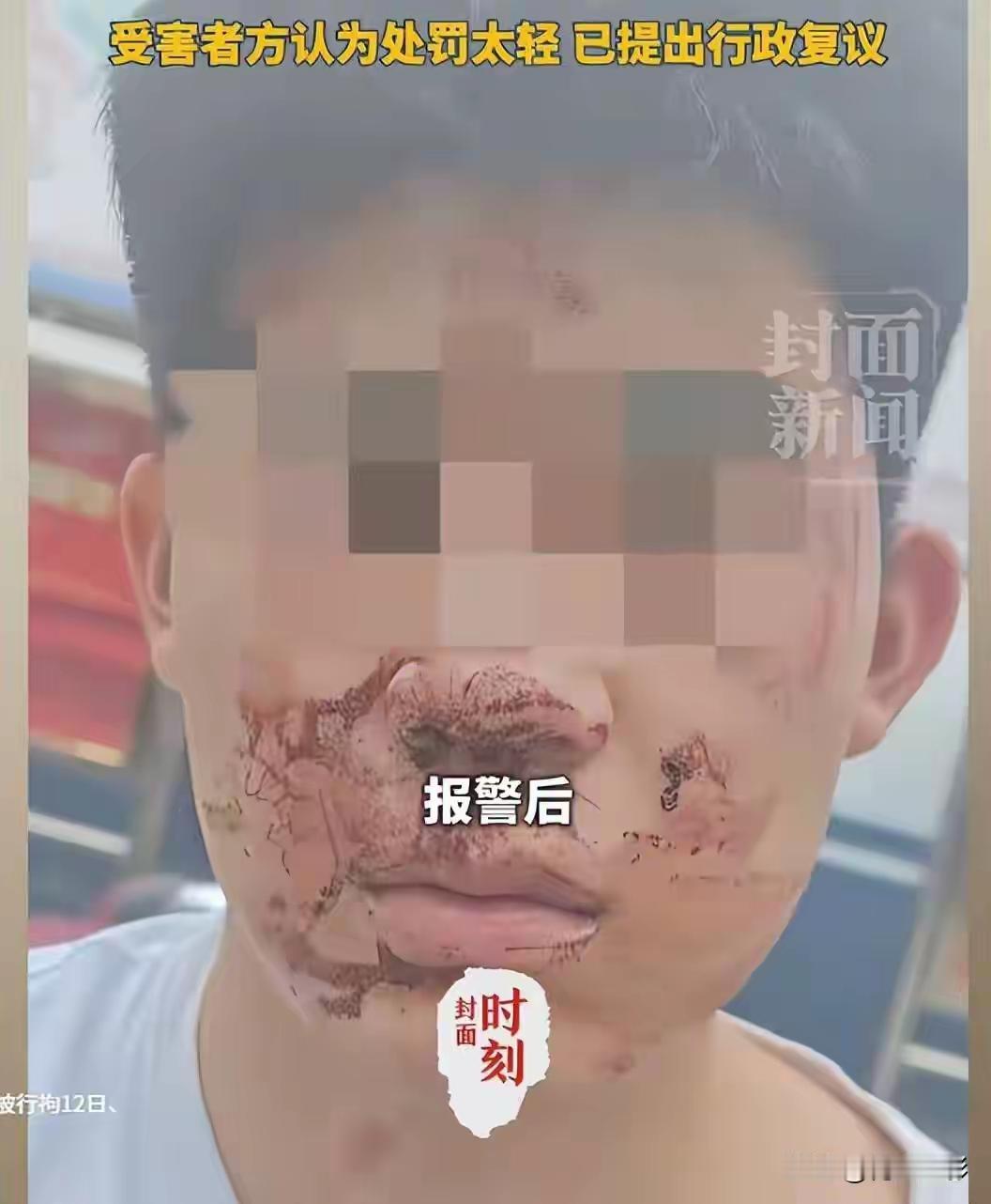 高考刚结束，有人就急着拿钱“平事”。山西运城这起打人案，不只是学生打架那么