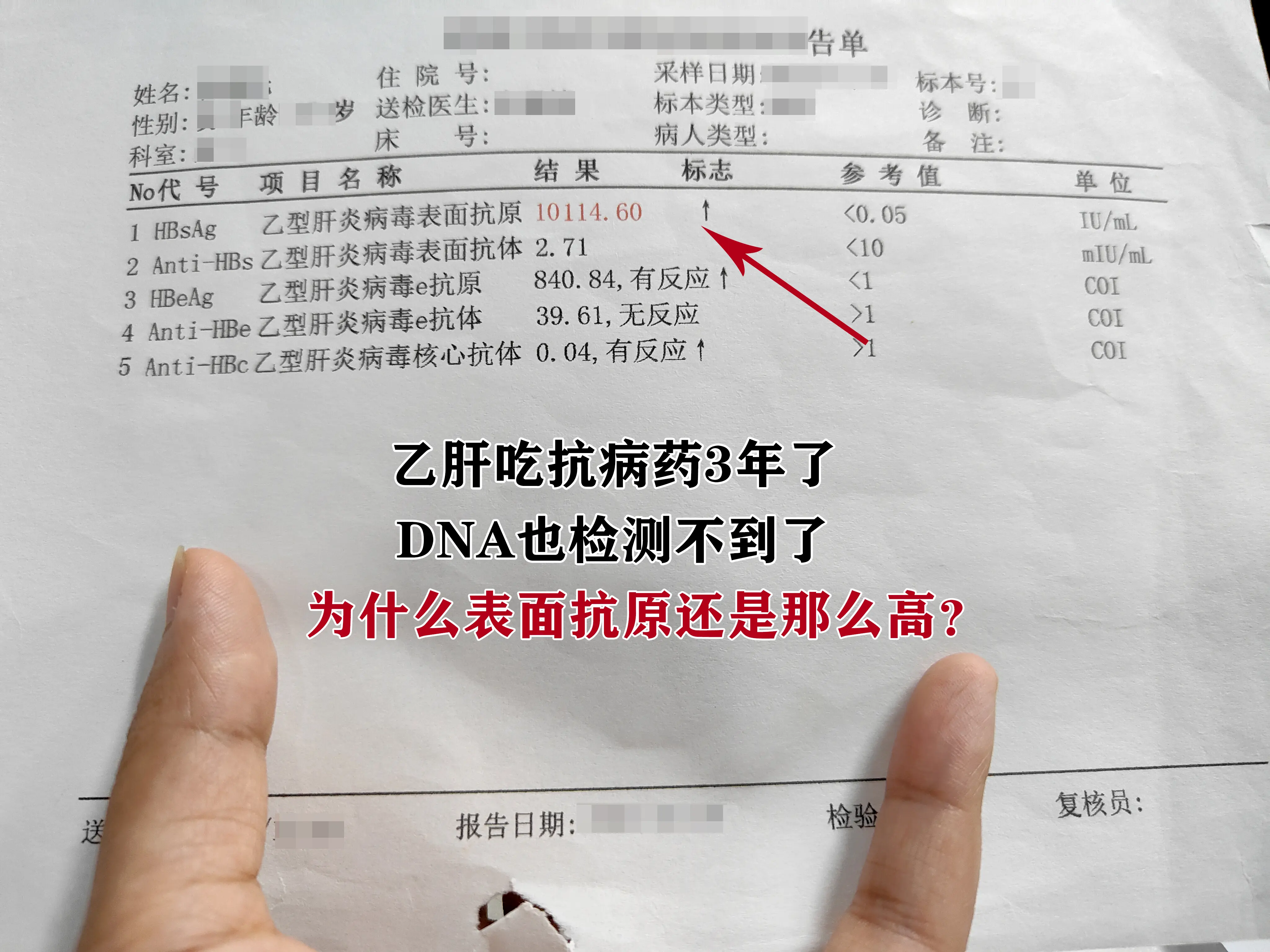 乙肝吃抗病药3年了，DNA也检测不到了，为什么表面抗原还是那么高？还有...