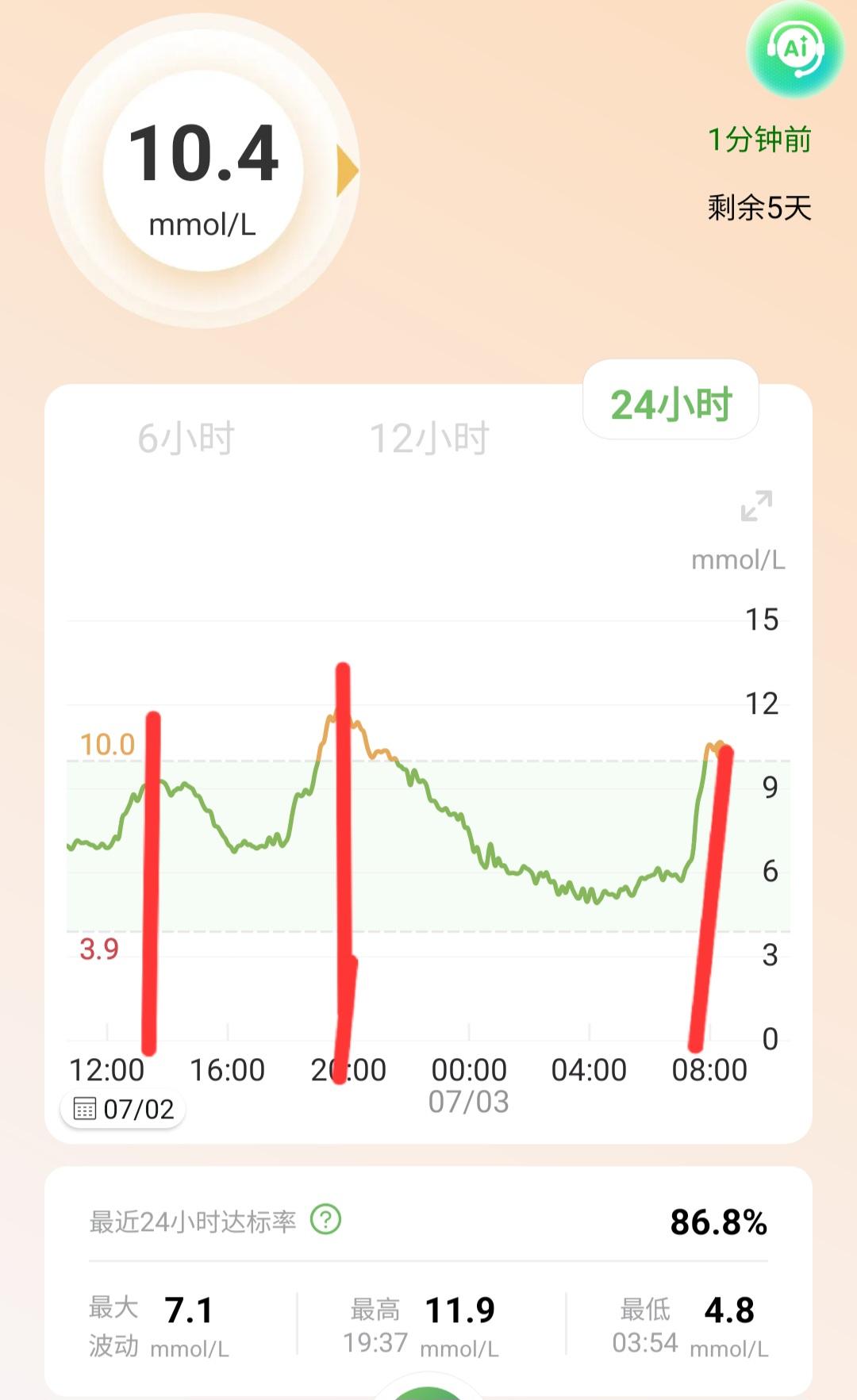 控制血糖这件事24小时实测说明有规律：1、吃饭用餐升糖，这个都知道；2、餐后