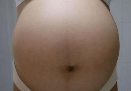 孕检医生说孩子可能保不住做好心理准备, 回家后儿子的话救回妹妹
