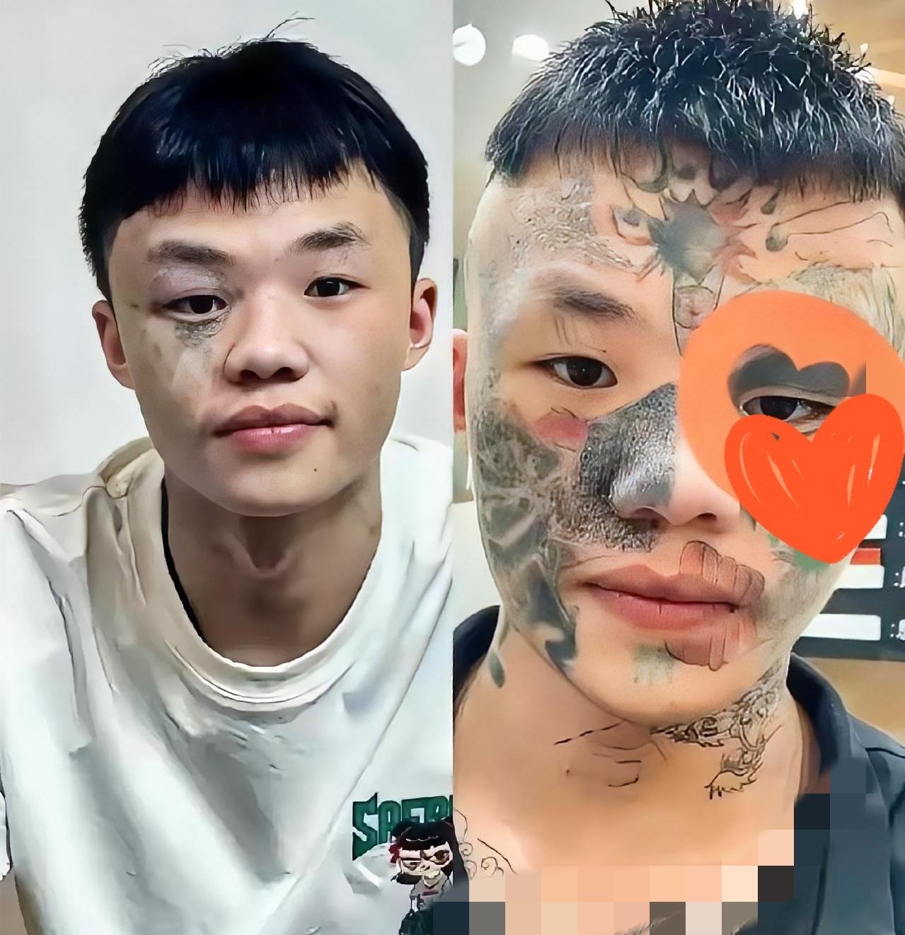 广东男孩夏朝勇这事儿，看着真让人心疼！13岁为唬人纹面，19岁得挨5次“烟头烫脸