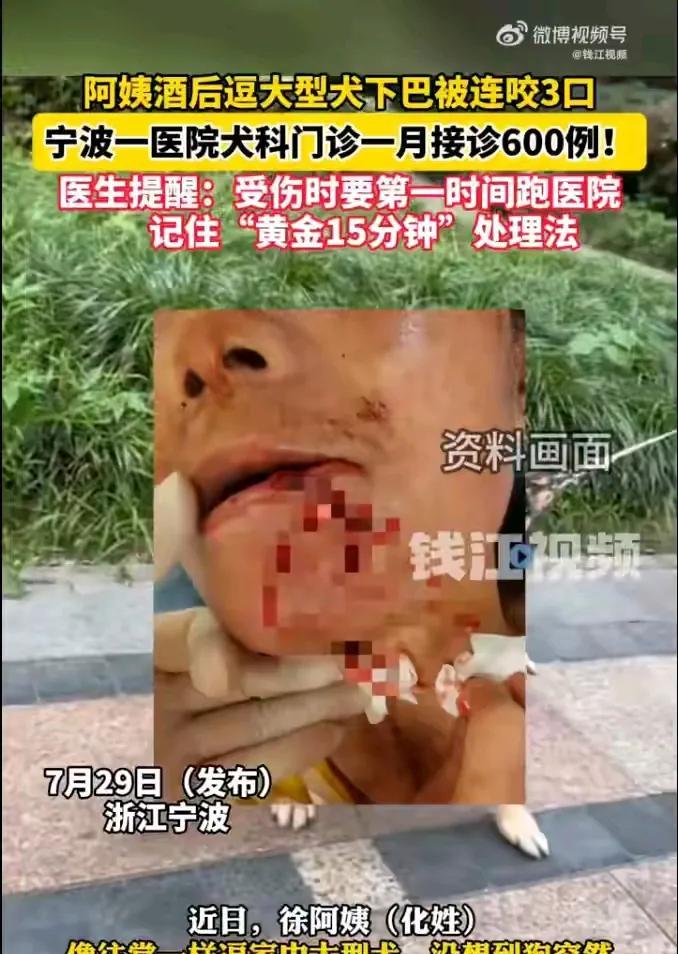 阿姨逗家中大型犬下巴被连咬三口，宁波一个医院犬科门诊一月接诊600例。狗不会说