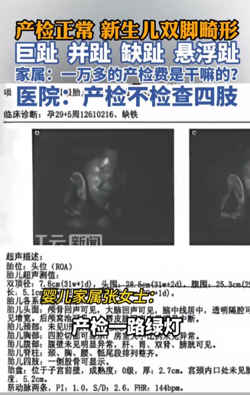 医院良心何安？广东珠海，26岁孕妇在医院花了一万多做完全部产检，八次检查结果全部