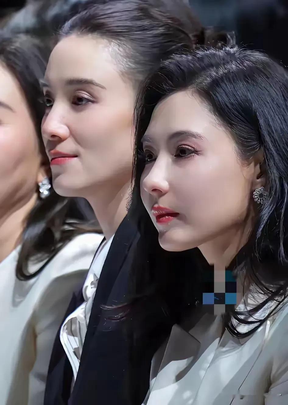 太可惜了，没想到张柏芝也去医美了！关键是医美后，脸鼓鼓囊囊，看起来怪怪的，都快认不出是本尊了。再看看