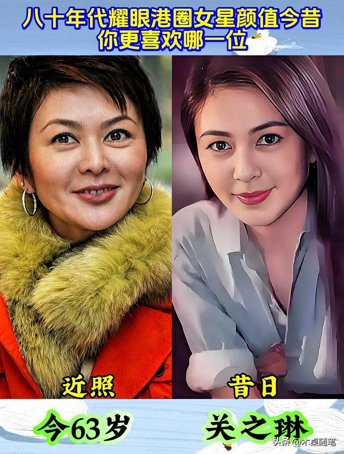 关之琳年轻时的五官精致,颜值超高,身材比例好,四肢修长,皮肤雪白,头发浓密,气质
