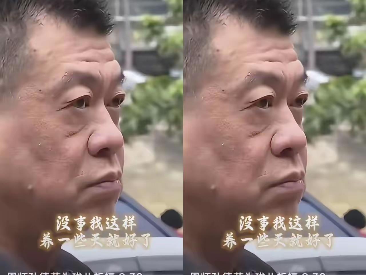 孙德荣拖着病体赴京这事儿，越想越让人鼻子发酸！六十几岁的人，膀胱癌术后靠大肠做人