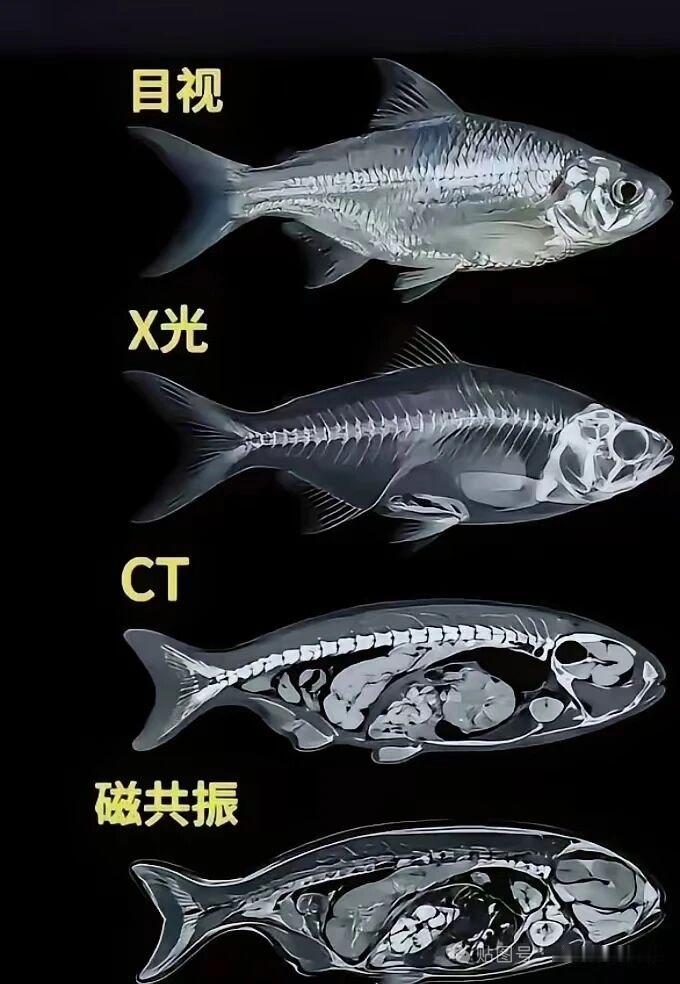 “您身边有没有这样的朋友？一说去医院拍片子，就觉得自己要‘吃射线’了？今天咱