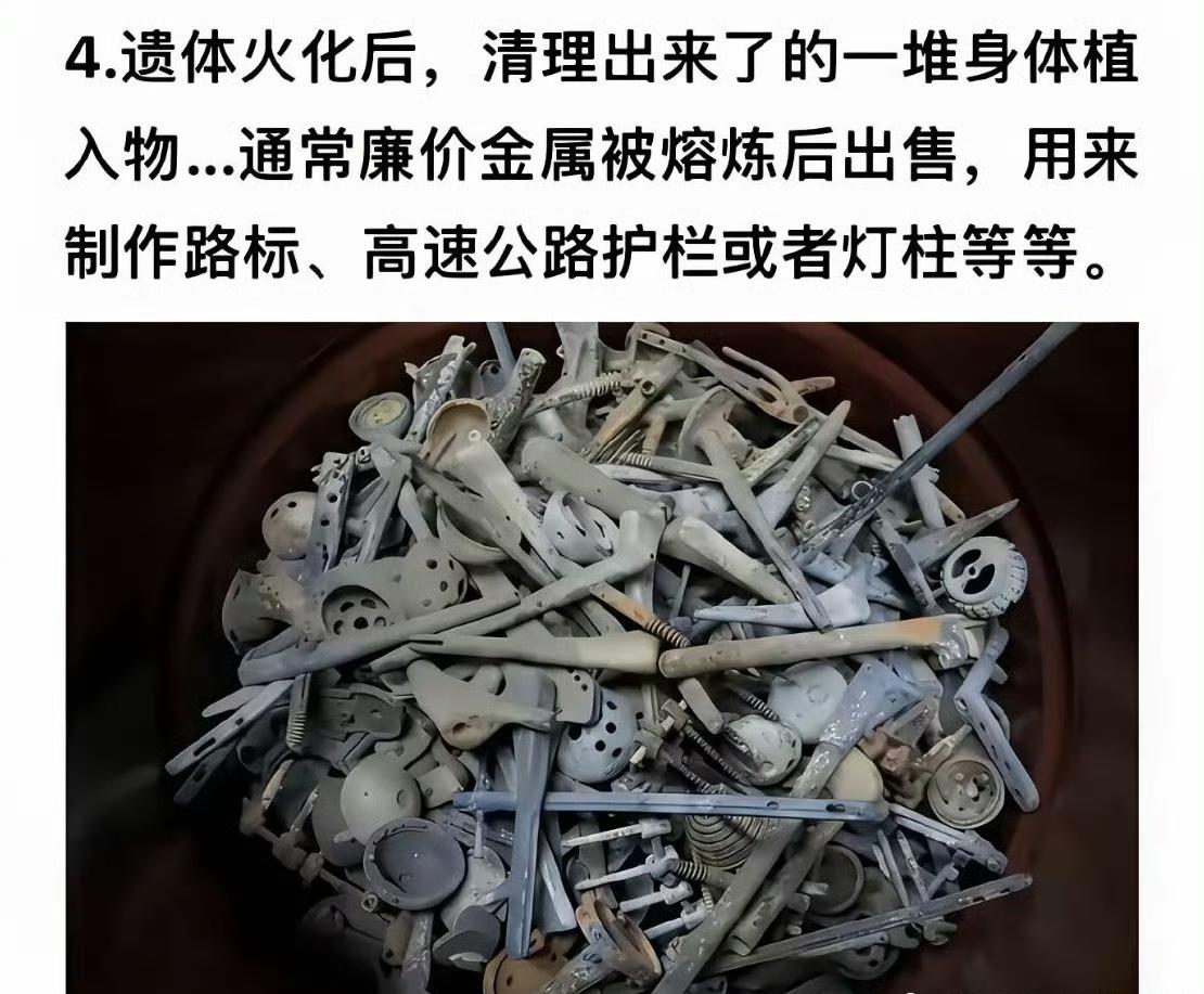 每一根钉子都是好几万吧？人死了之后，身体里的一些植入物：人工关节、心脏支架、钢