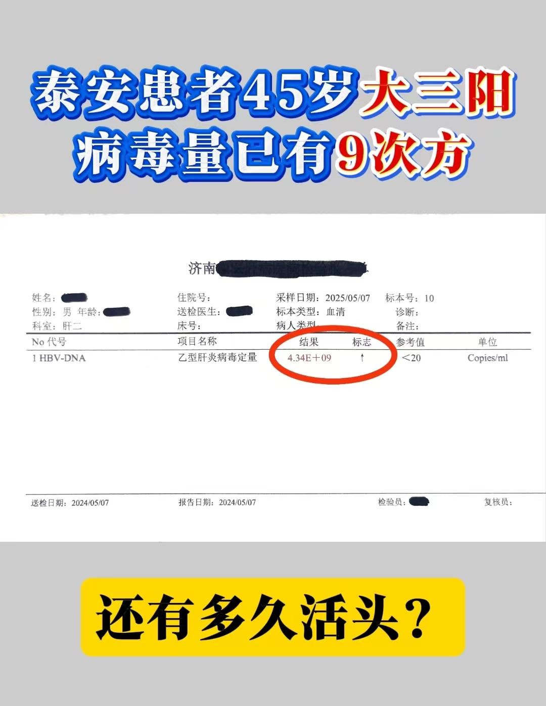 泰安患者45岁大三阳，病毒量已有9次方，患者本人非常的惊慌，说自己这么...