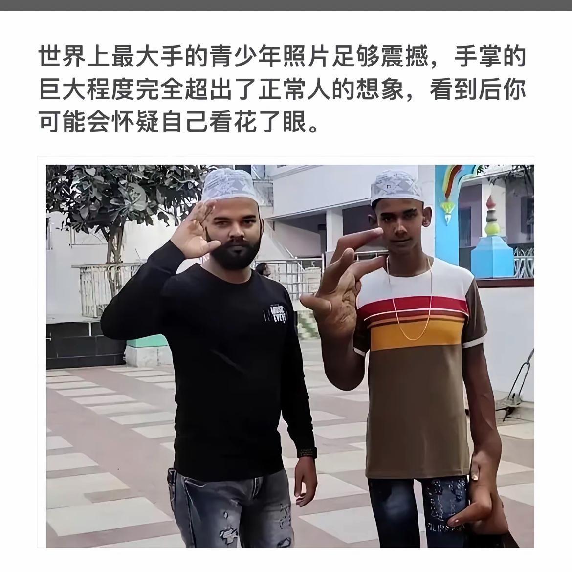 “震惊！史上最大手掌的青少年照片曝光！”😱👏