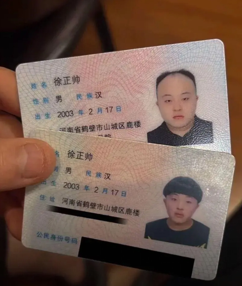 才十年头发就快掉没了