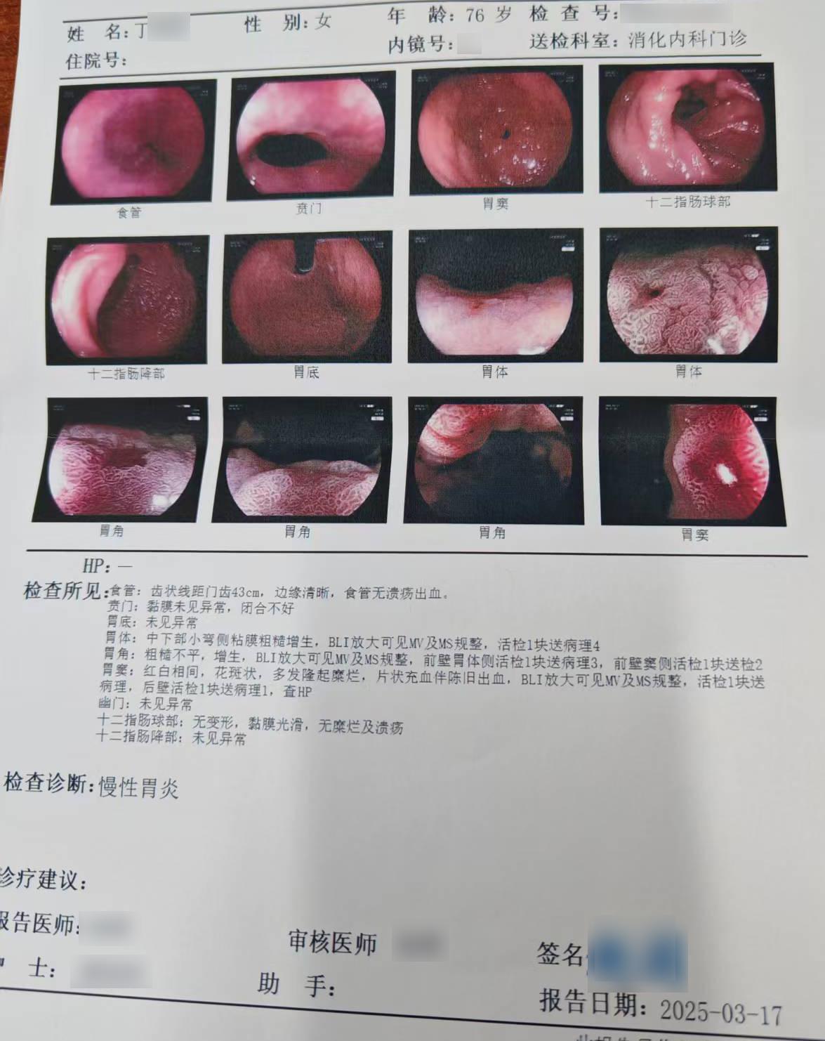 胃病想好，先照我说的做！30天后你会感谢我北京公立三甲洪惠玲医生：“因为生活