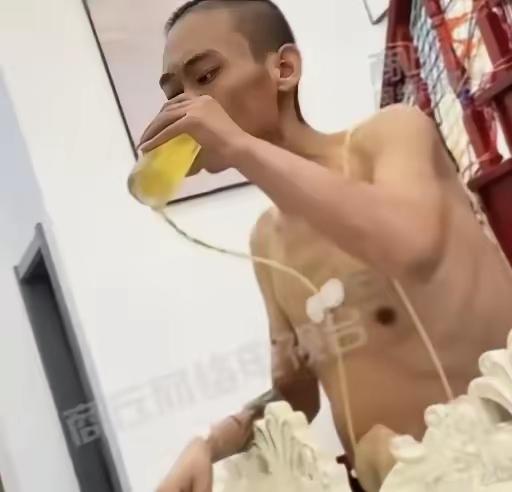 早死晚死都得死，不如想喝啥喝啥，想吃啥吃啥！这个叫张伟的男子，体检中查出重症