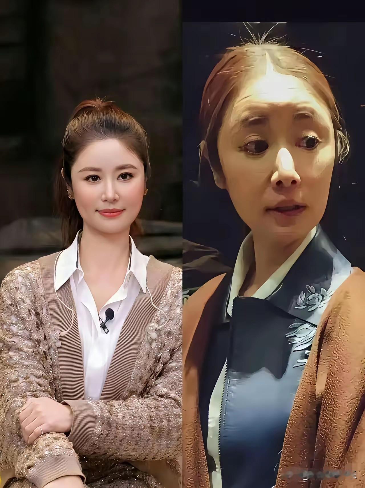 医美还真神奇，一夜之间她的老态全不见了，取而代之的是饱满紧致的脸蛋和精致立体