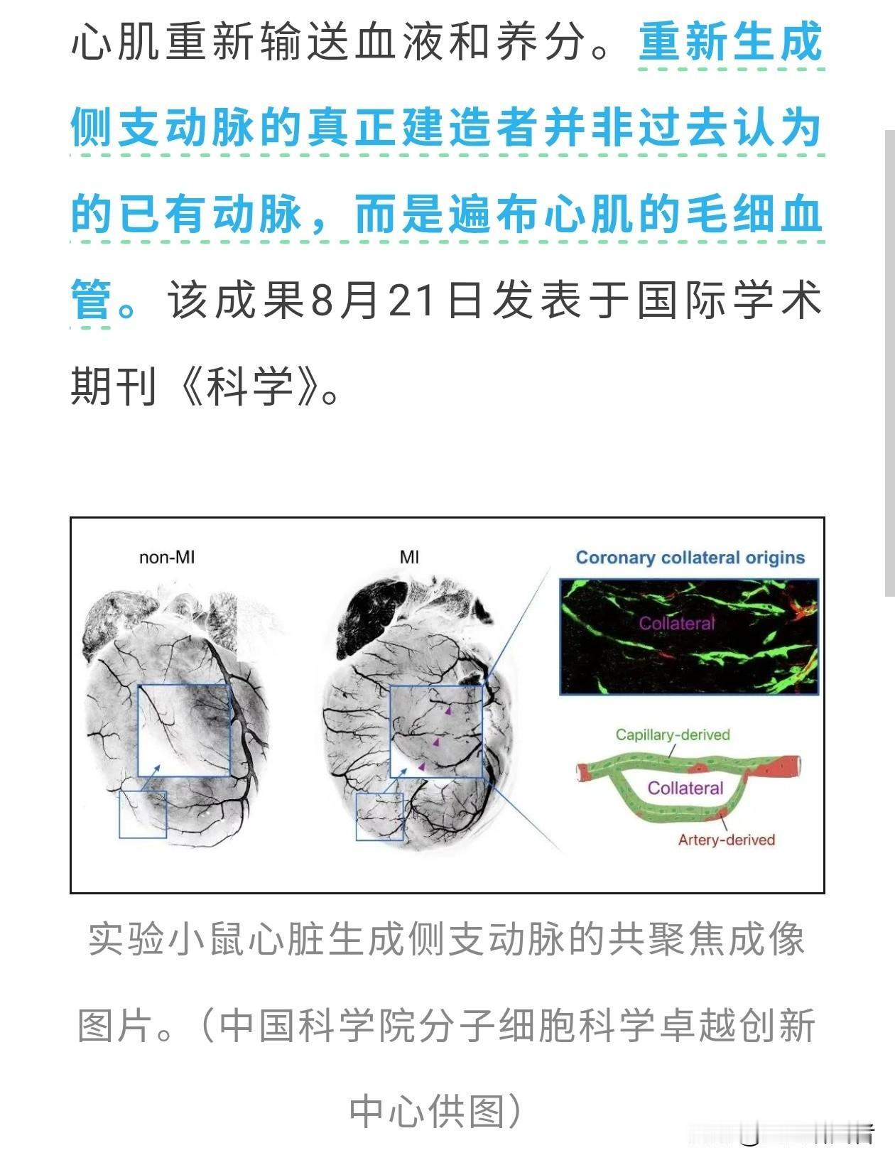 颠覆认知！中国科学家重大发现：心脏堵死了，自己会偷偷修“救命通道”很多人都