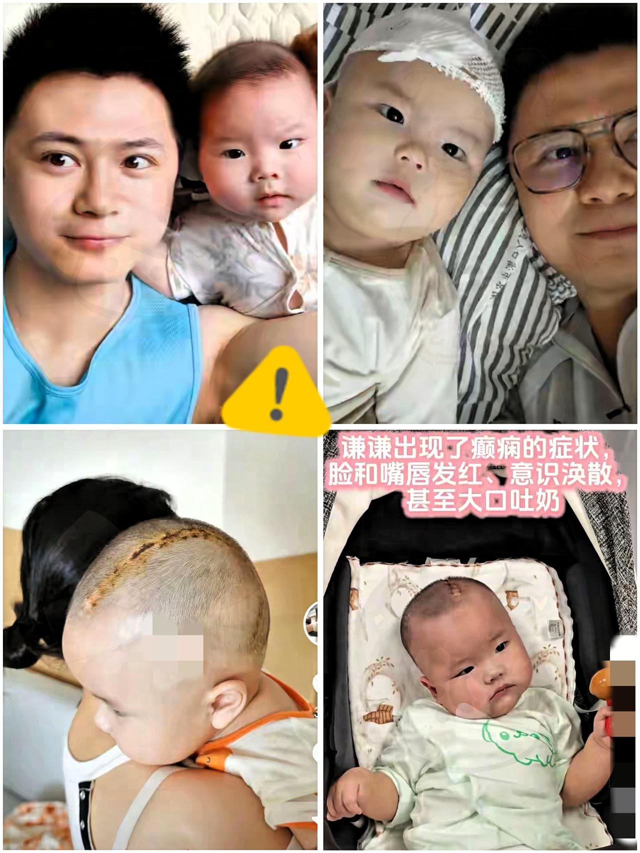 7个月宝宝谦谦摔伤致脑出血，诊断10个病，爸爸愤怒：外公没看好江苏7个月宝宝