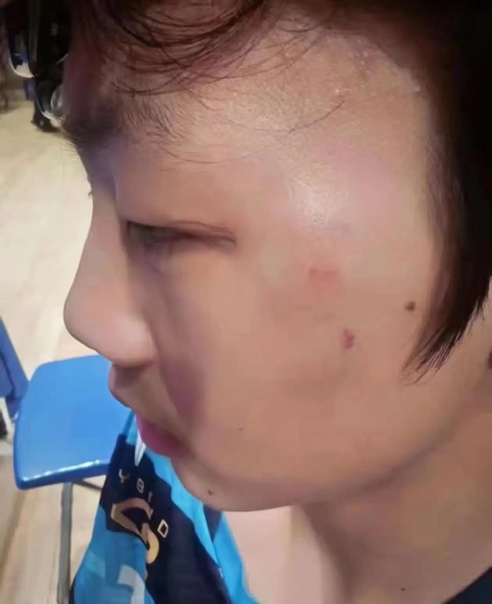输球挥拳殴打昔日队友，11比0背后藏着青少年体育教育的巨大漏洞被曹彦灏打的小