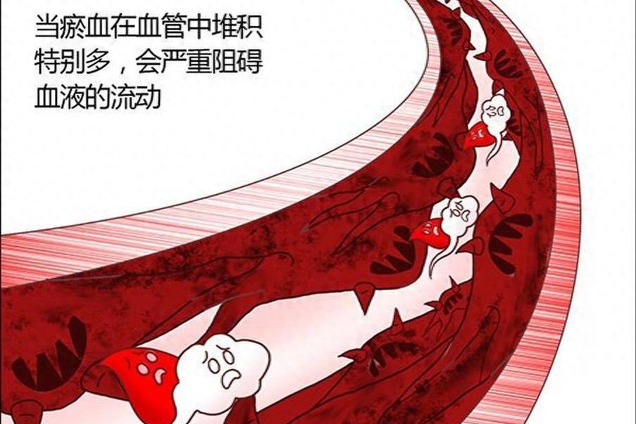 化瘀最大王牌竟是补阳！1味药：补一身阳气，活血消瘀，气色红润大家好，我是中医