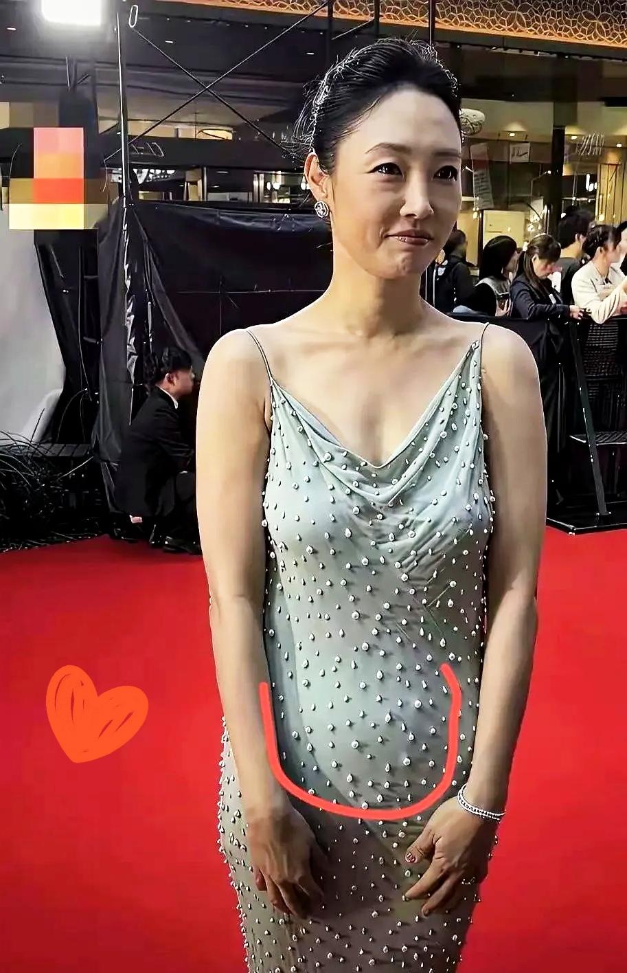 看到张照片，直接给我整沉默了。才41岁，硬是把自己折腾成了“老太太”。满脸的