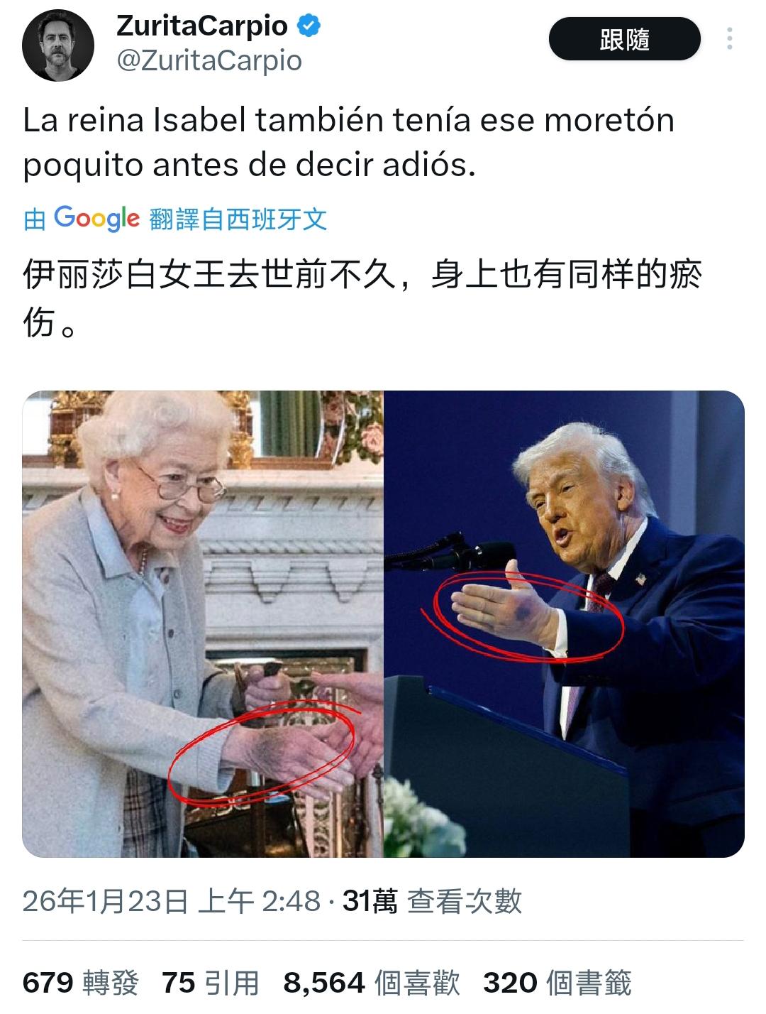 看到这张对比图和Grok的解释，绝大多数人的第一反应应该是咯噔一下：啊？不会吧？